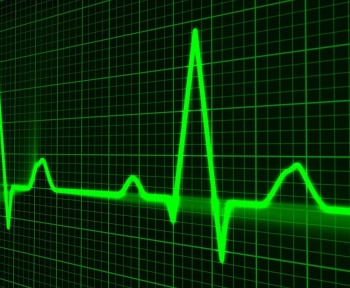 pulse trace, healthcare medicine, heartbeat, heart shape, medical equipment, equipment, symbol, graph, medical technical equipment, pulsating, medical supplies, wave pattern, computer graphic, monitoring equipment, heart beating, nobody, green computer, green heart, green laptop, green medical, green medicine, green pattern, green wave, green healthcare, green waves, green technical, heartbeat, heartbeat, heartbeat, heartbeat, graph, graph, graph, graph, graph